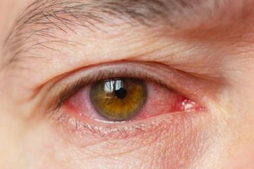 The Human Side of Dry Eye