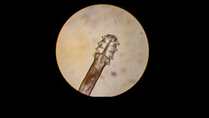 Your Friendly Eyelid Mites!