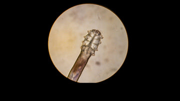 Your Friendly Eyelid Mites!