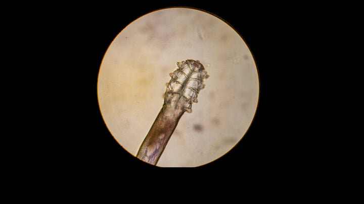 Your Friendly Eyelid Mites!