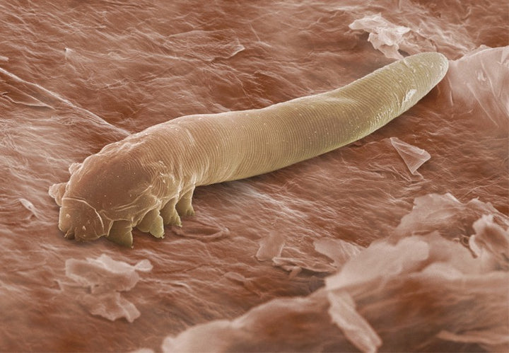 Your Friendly Eyelid Mites!